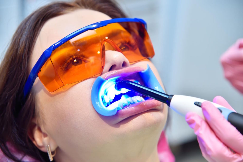 Metody wybielania zębów w domu mogą być skuteczne, ale efekty będą różnić się w zależności od indywidualnych uwarunkowań