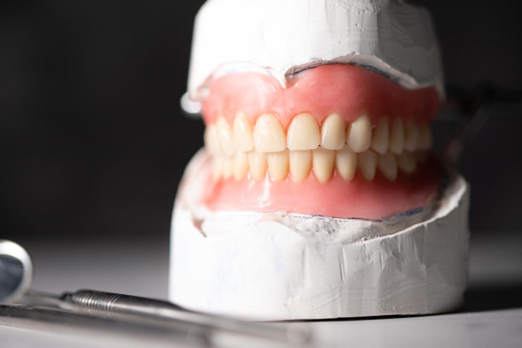 Specjaliści stomatologii poznańskiej nieustannie poszukują nowych rozwiązań i technik, które pozwolą na jeszcze skuteczniejszą odbudowę zębów